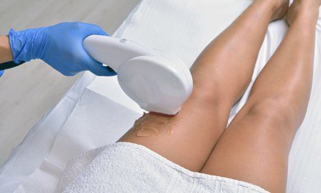 Donna che ottiene gambe trattamento laser della pelle in un salone di bellezza