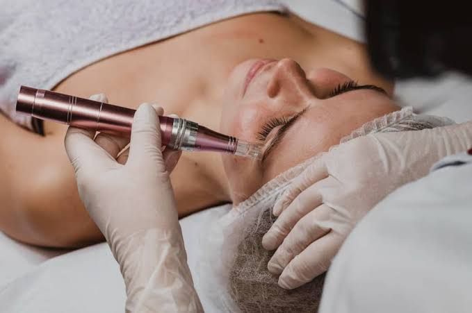 Durante un tratamiento facial en un spa, un profesional con guantes utiliza un dispositivo cosmético para tratar la piel