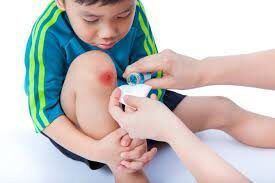 A child is getting a bandage on his knee.