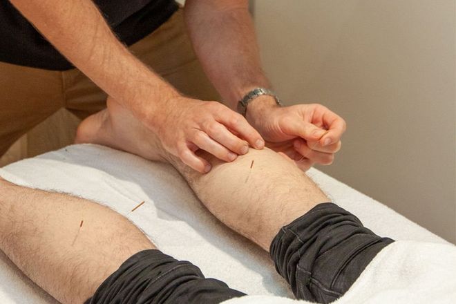 Ash Dry Needling on Functional Myotherapy