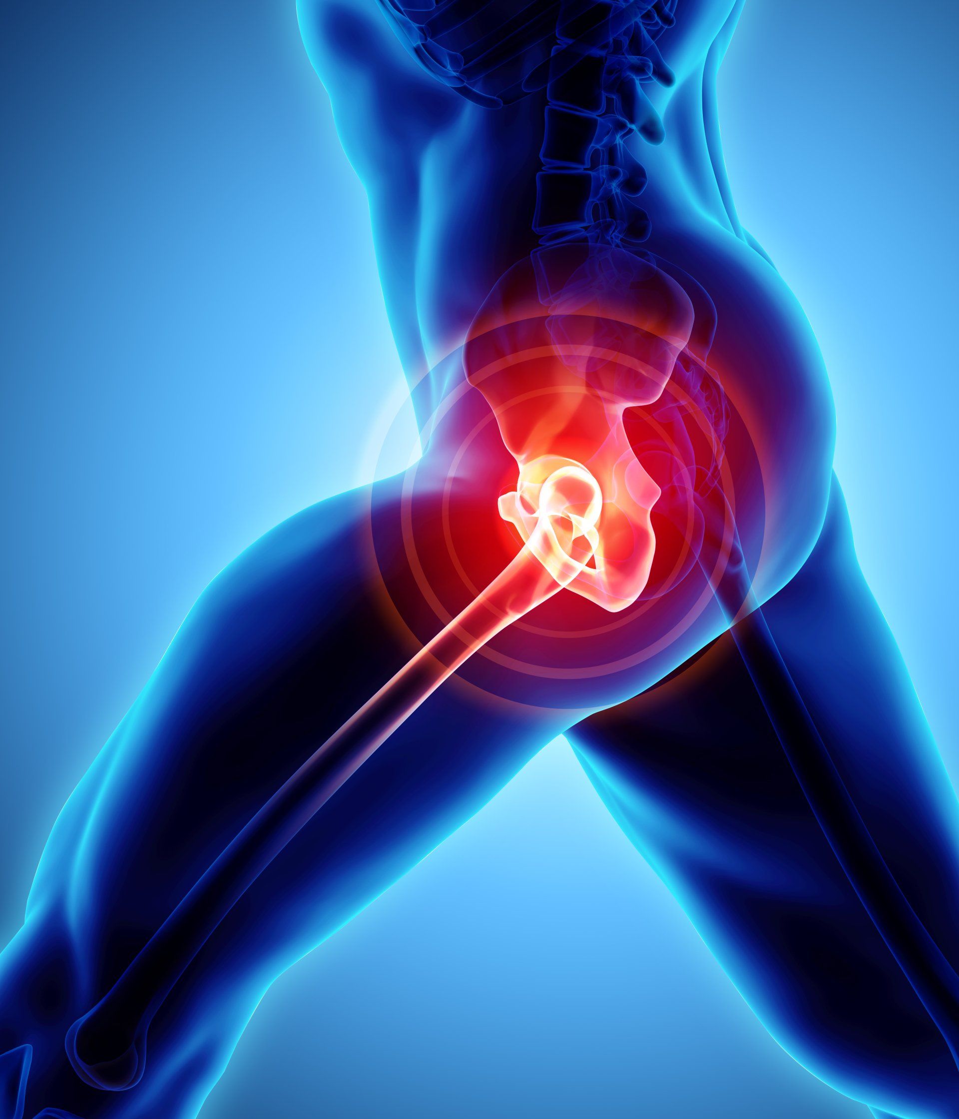 Hip Pain - Santa Clarita Valley Therapy Services