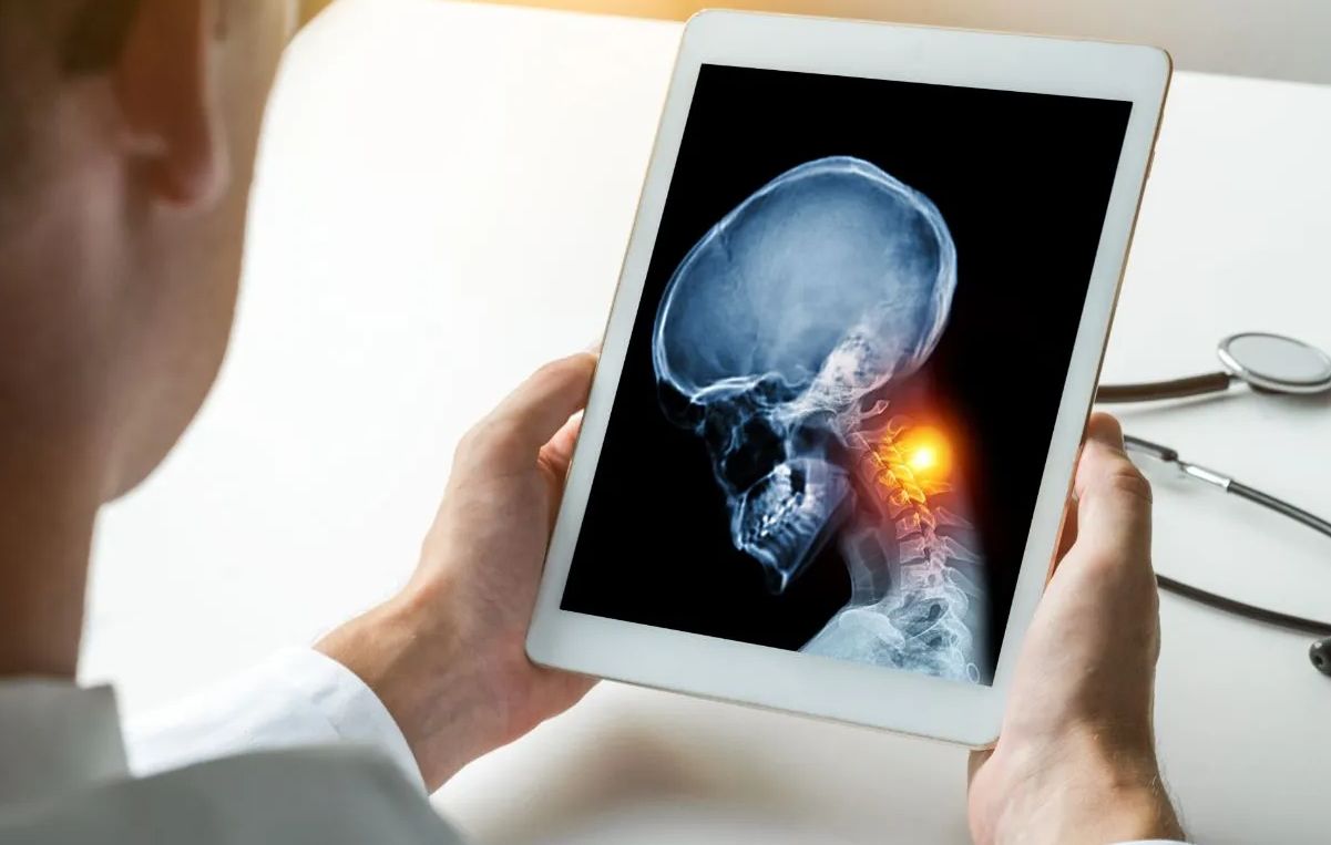 Interventional Pain Management