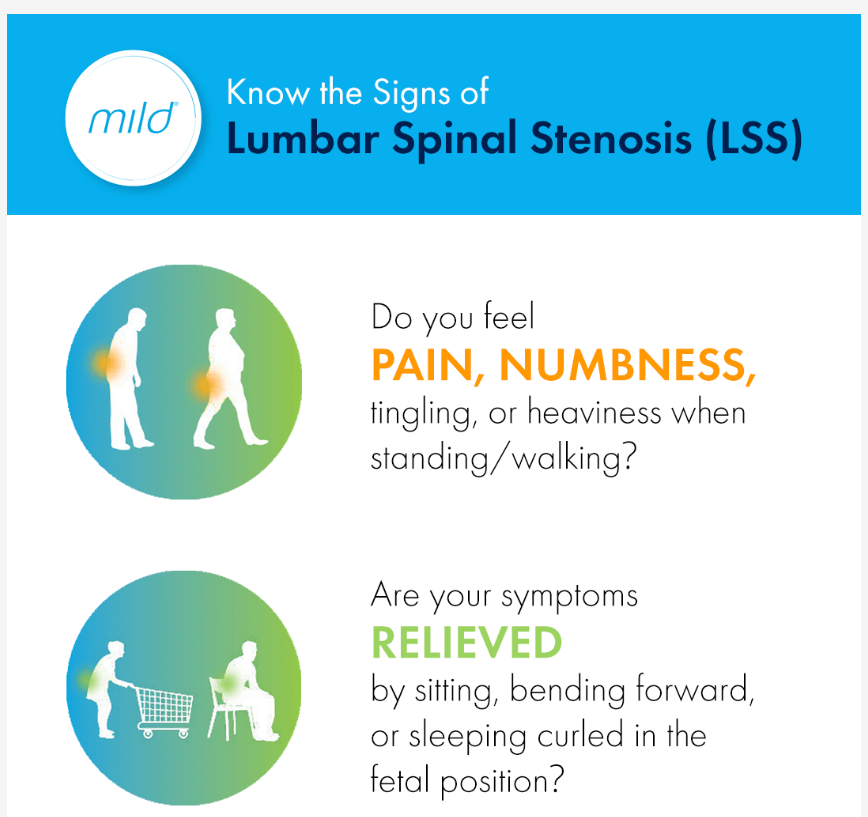 Signs and Symptoms of Spinal Stenosis