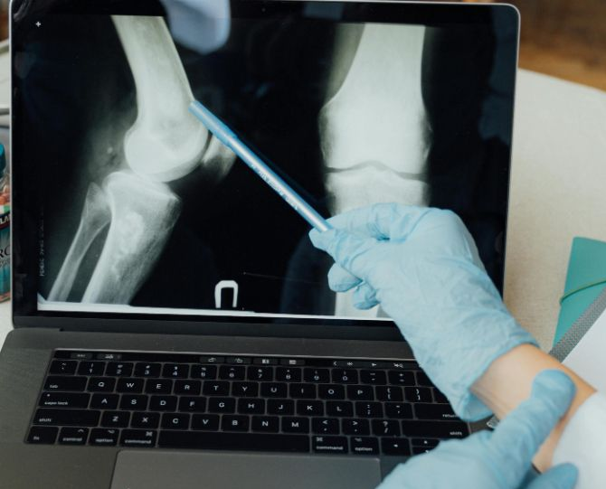 Orthopedic Surgeon Lancaster