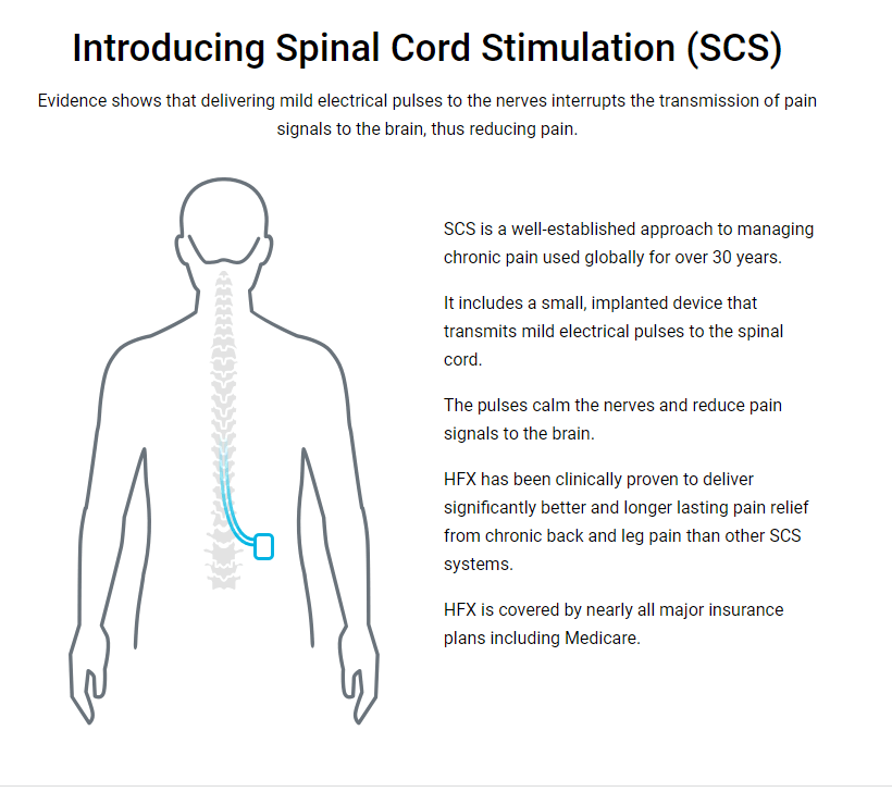 Learn How Spinal Cord Stimulators Provide Pain Relief After Failed Back  Surgery: Glaser Pain Relief Center: Interventional Pain Management  Specialists