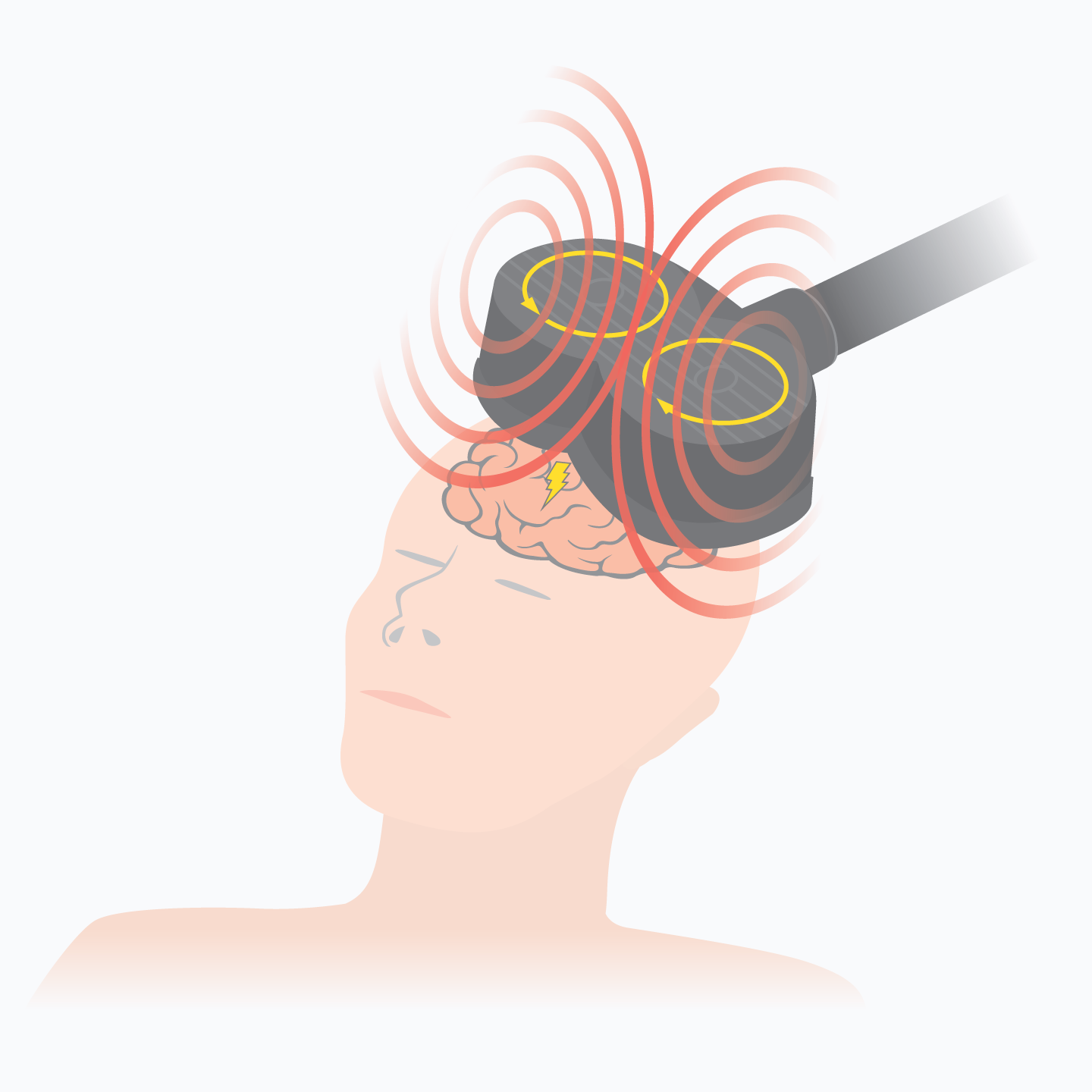 An illustration of a person getting a magnetic treatment on their head.