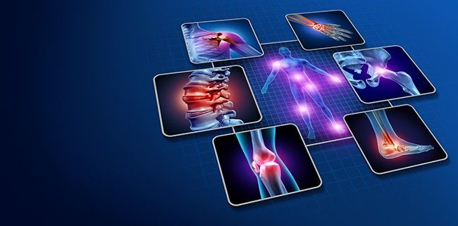 A medical illustration of the human body with various pain points.