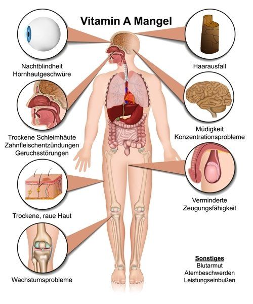 Gesund plus Fit hilft bei Vitamin A Mangel