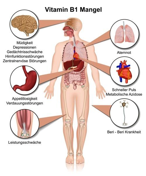 Gesund plus Fit hilft bei Vitamin B1 Mangel