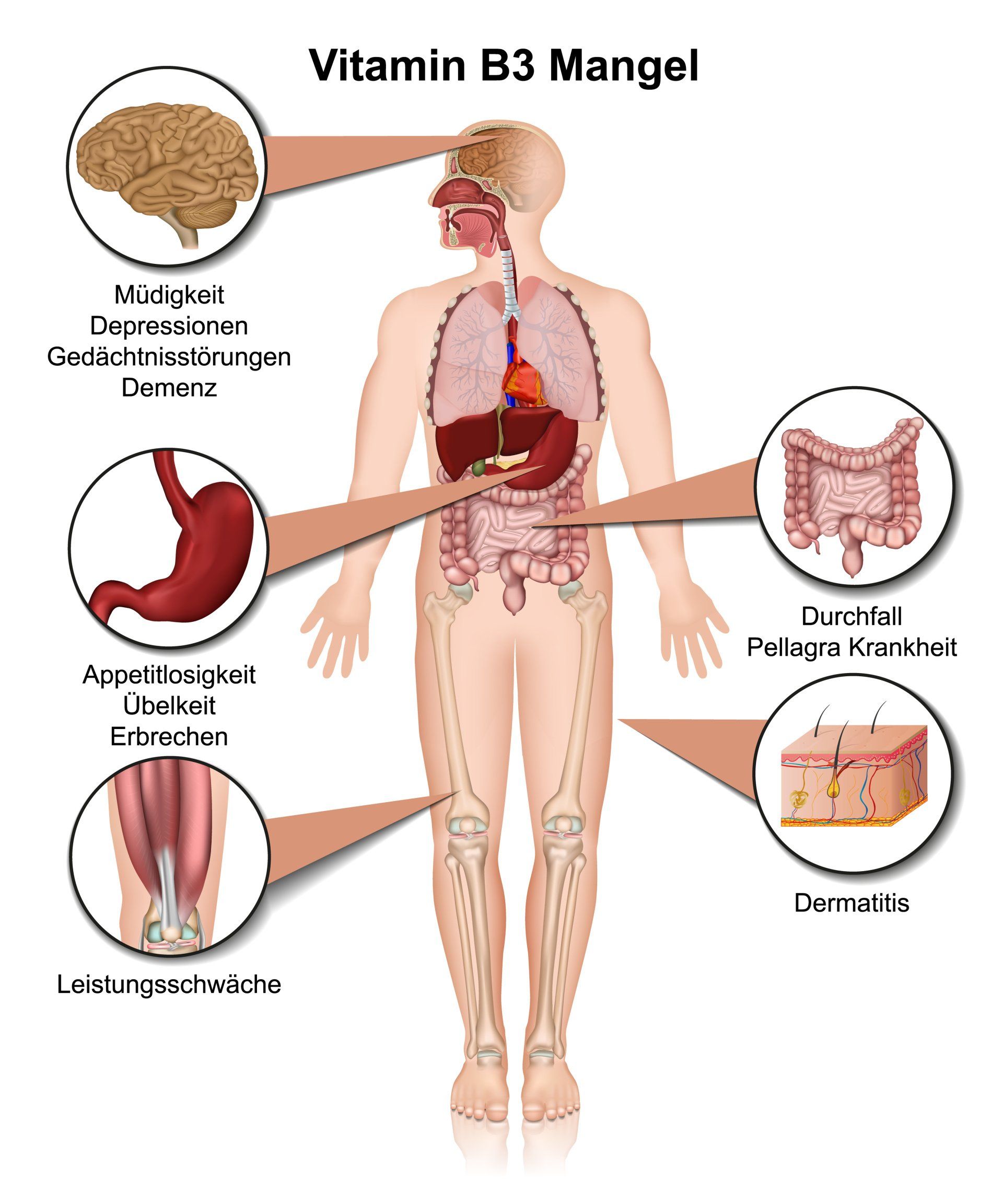 Gesund plus Fit hilft bei Vitamin B3 Mangel