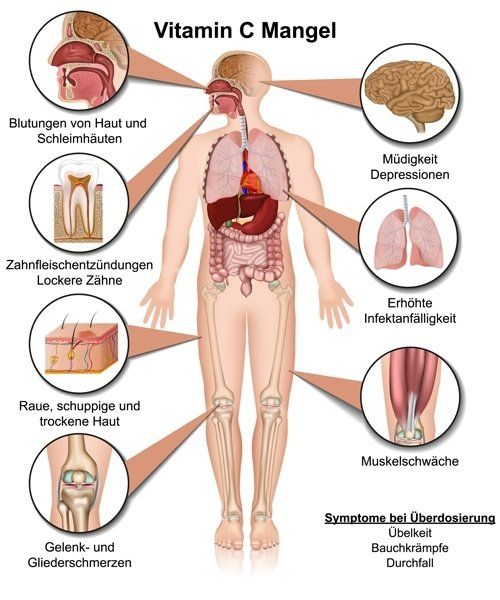 Gesund plus Fit hilft bei Vitamin C Mangel
