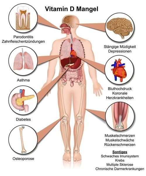 Gesund plus Fit hilft bei Vitamin D Mangel