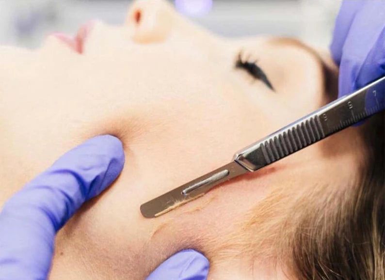 A woman is getting a facial treatment with a scalpel.