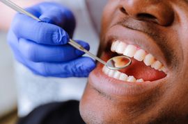 teeth examined at dentists