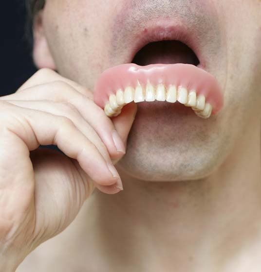 Man with dentures