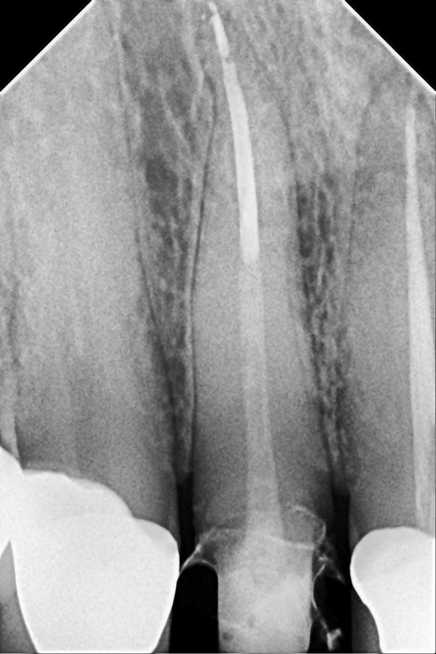 Un dentista está trabajando en un modelo de dientes con un cepillo.