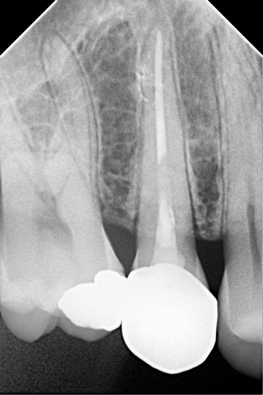 Una mujer está sentada en una silla dental mientras un dentista le examina los dientes.