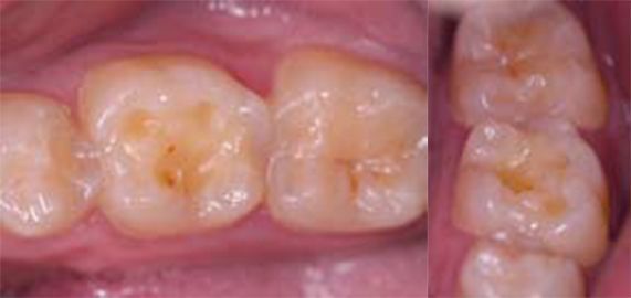 A close up of a person 's teeth with a pink background