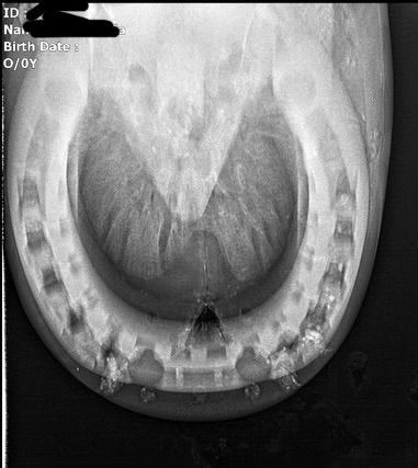 X-ray of a horse's hoof, showing bone structure and a horseshoe attached to the bottom.
