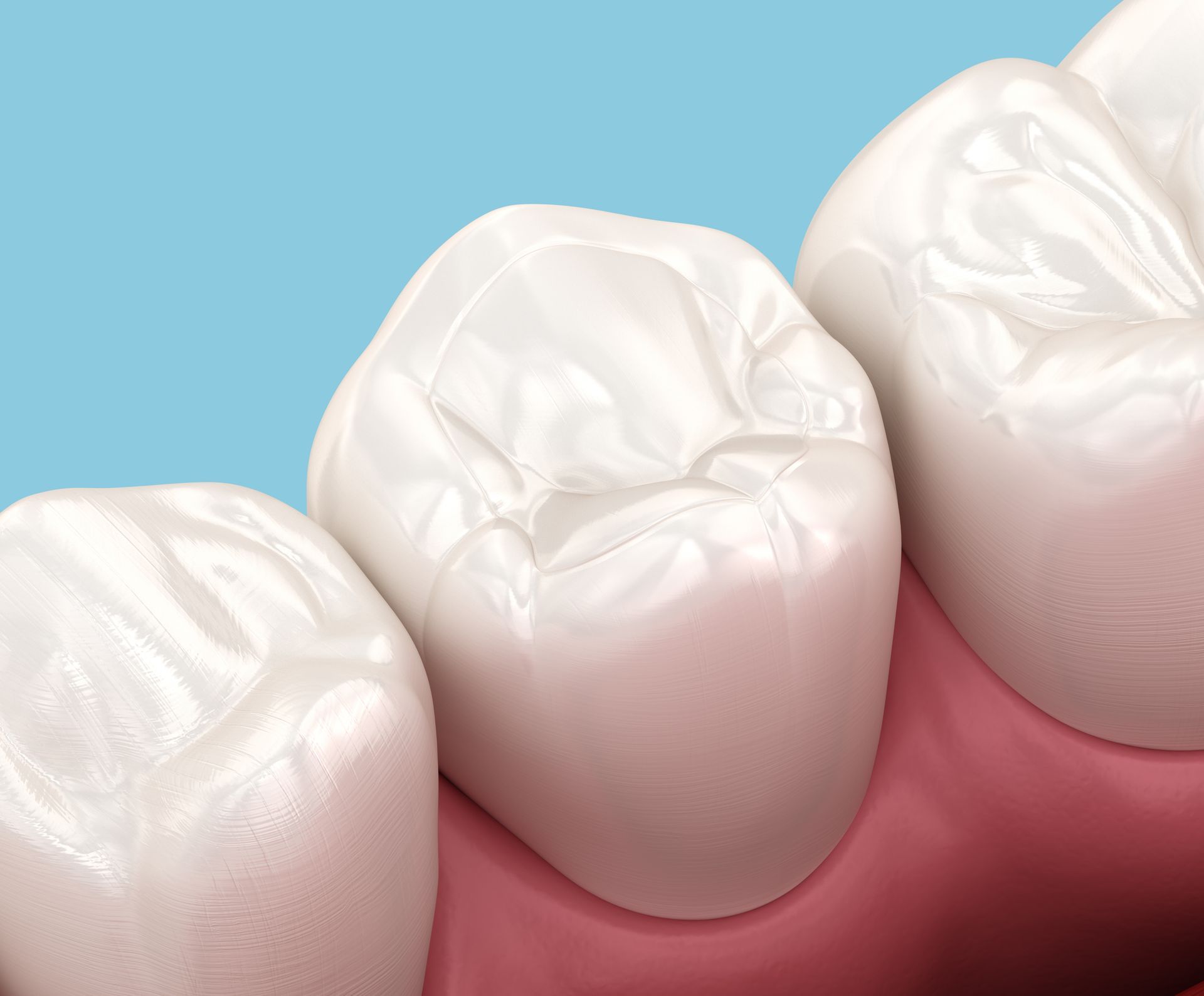 Close-up of three white molars with pink gums in a clean dental-style illustration
