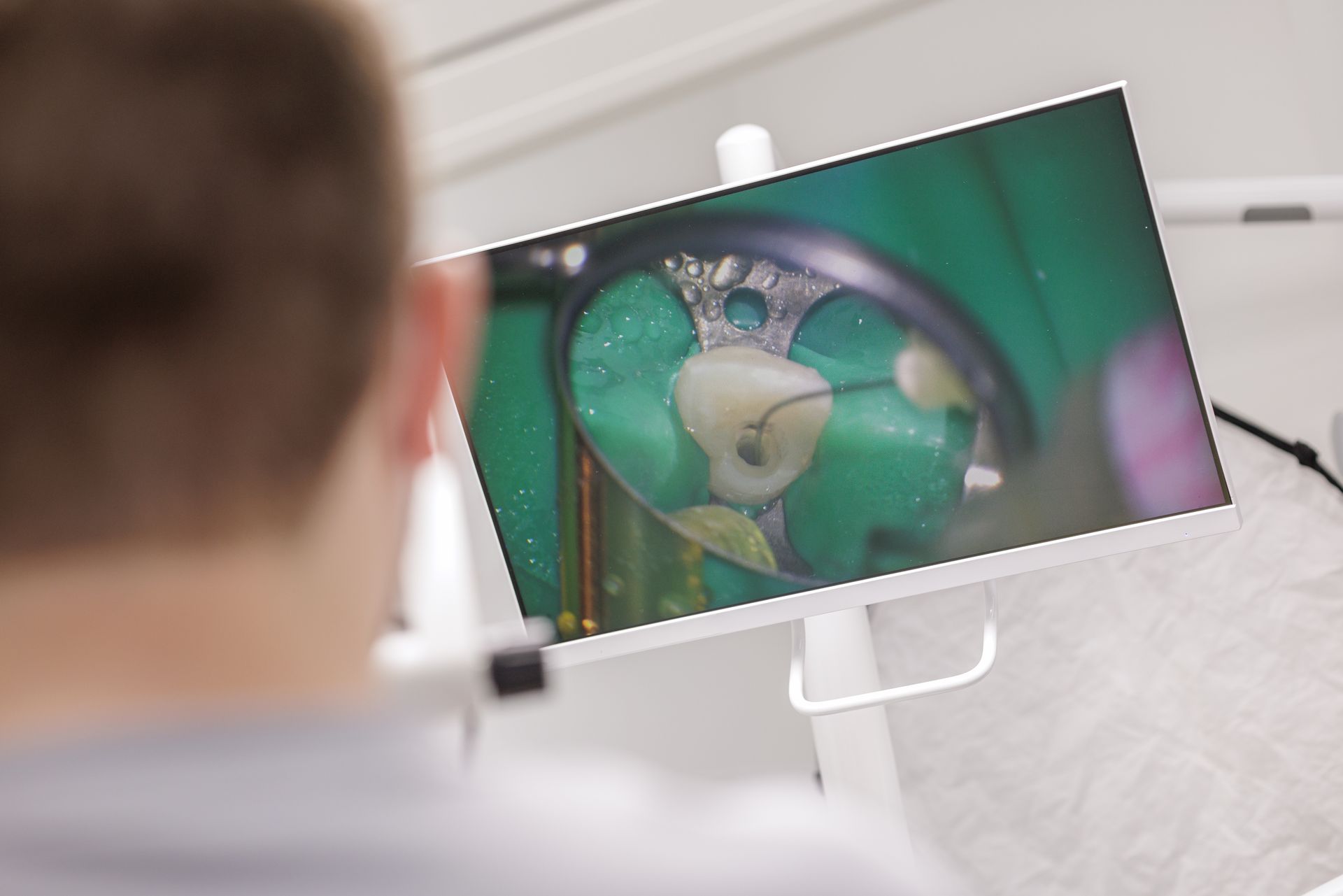 Person viewing a dental procedure on a monitor in a bright clinic room