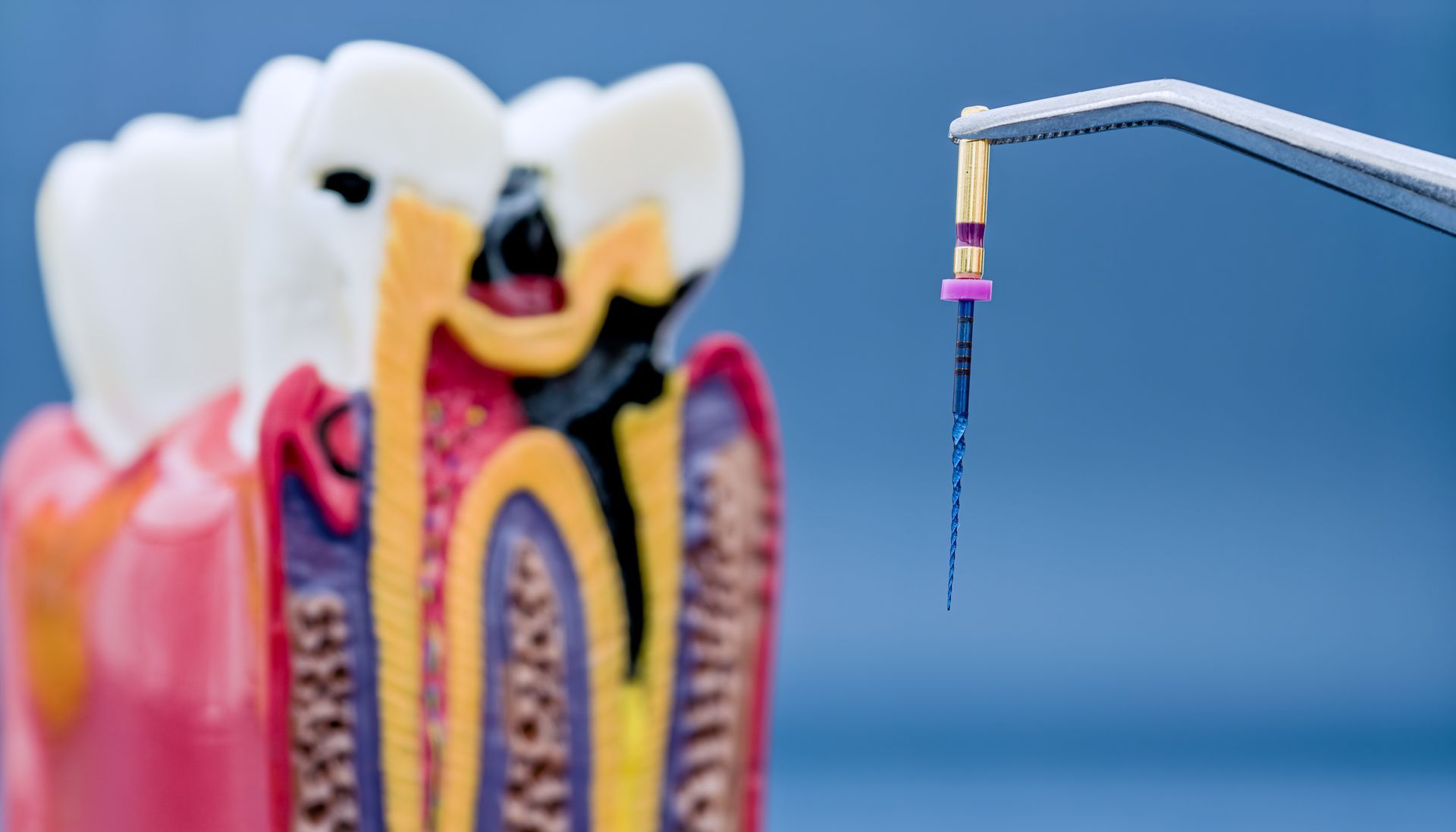 Dental model with colorful braces and a blue orthodontic tool against a blue background