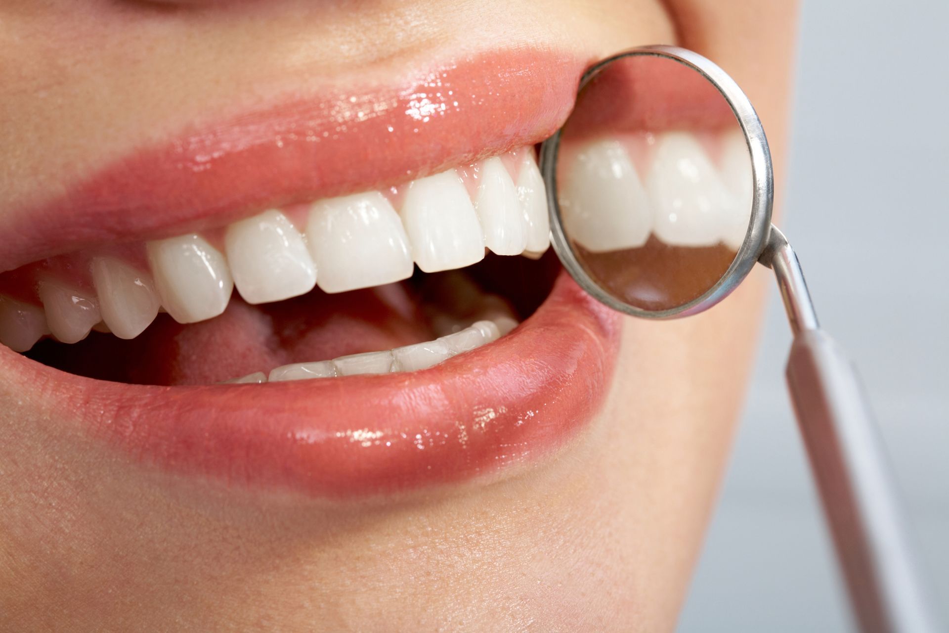 Close-up of a smiling mouth with teeth being examined by a dental mirror