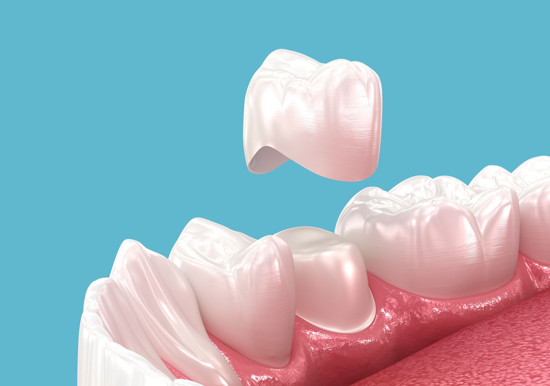 Floating white tooth above a pink gum line on a blue background