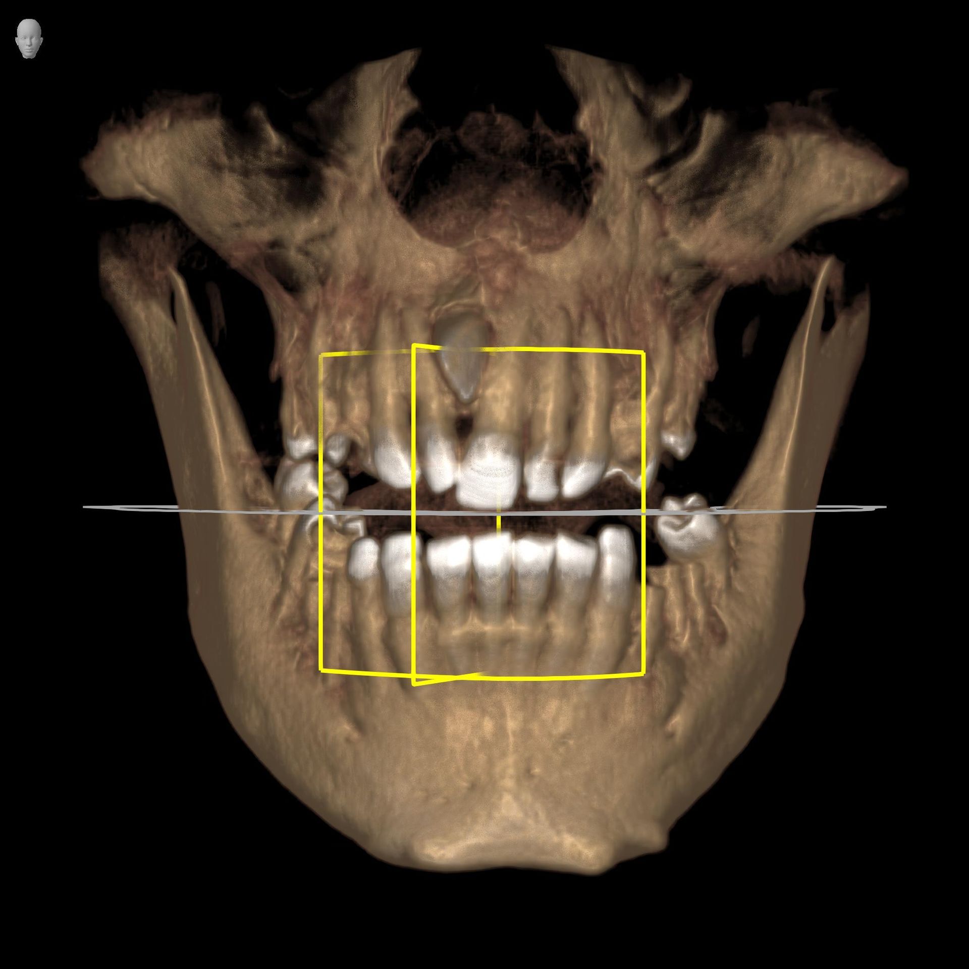 dentalscan 3d catania