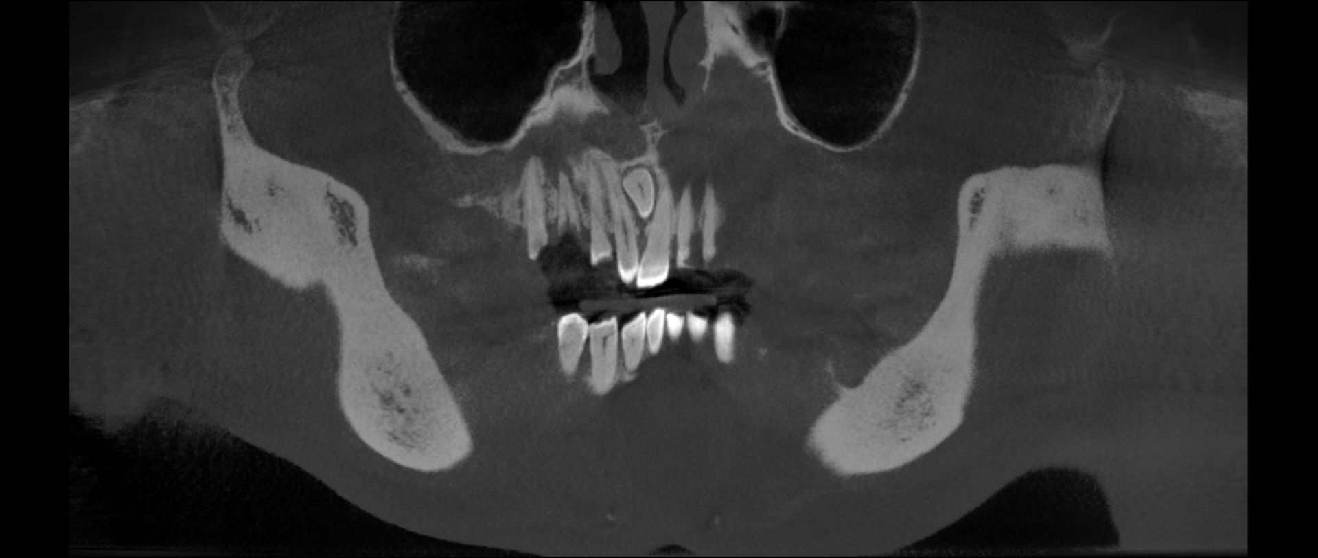 Dentalscan 3D-TC Cone Beam