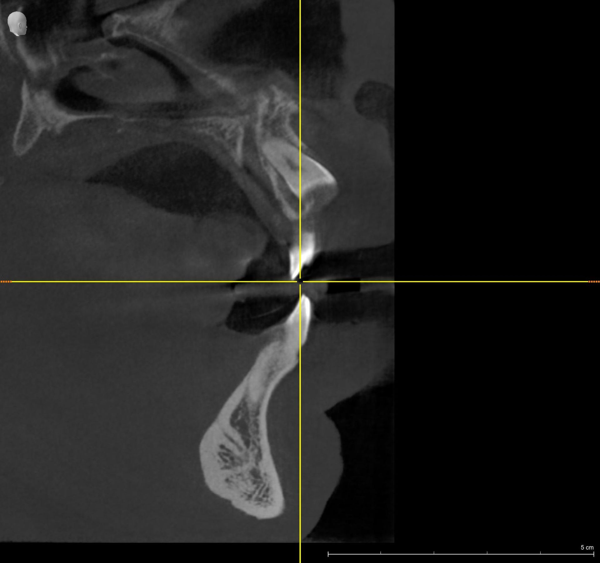 esame di arcate dentarie