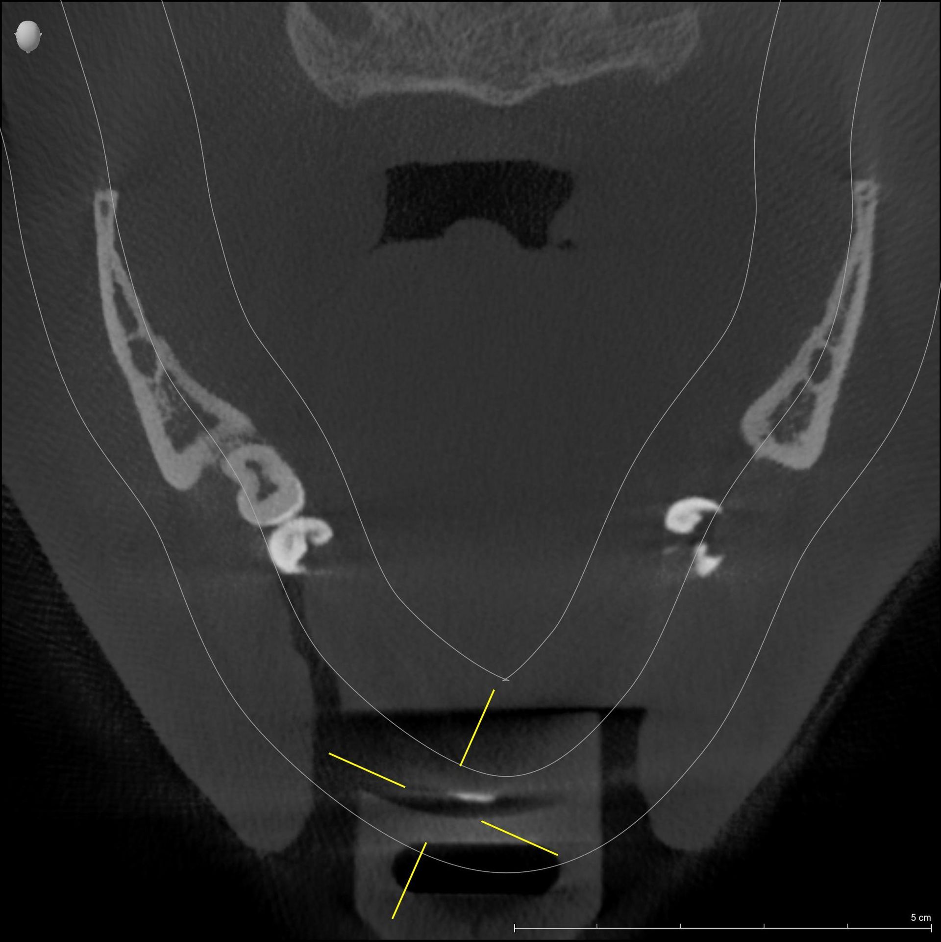 Dentalscan 3D catania