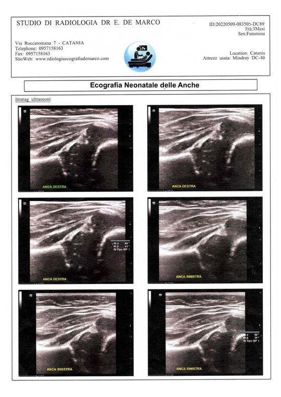 ecografia neonatale delle anche catania