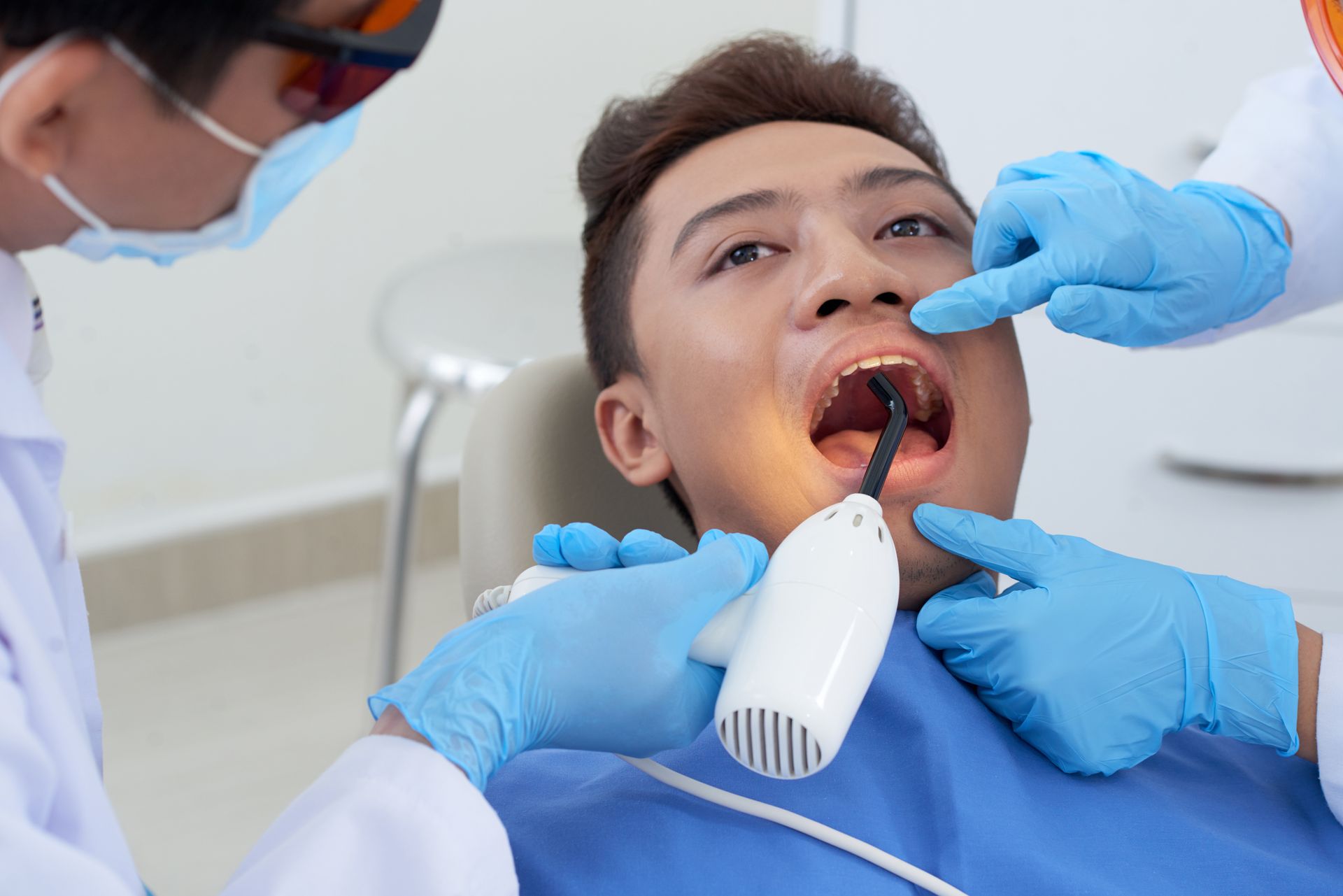lingual frenectomy 

