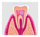 Root Canal Treatment - Crown Point Dental