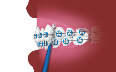 interdental toothbrush