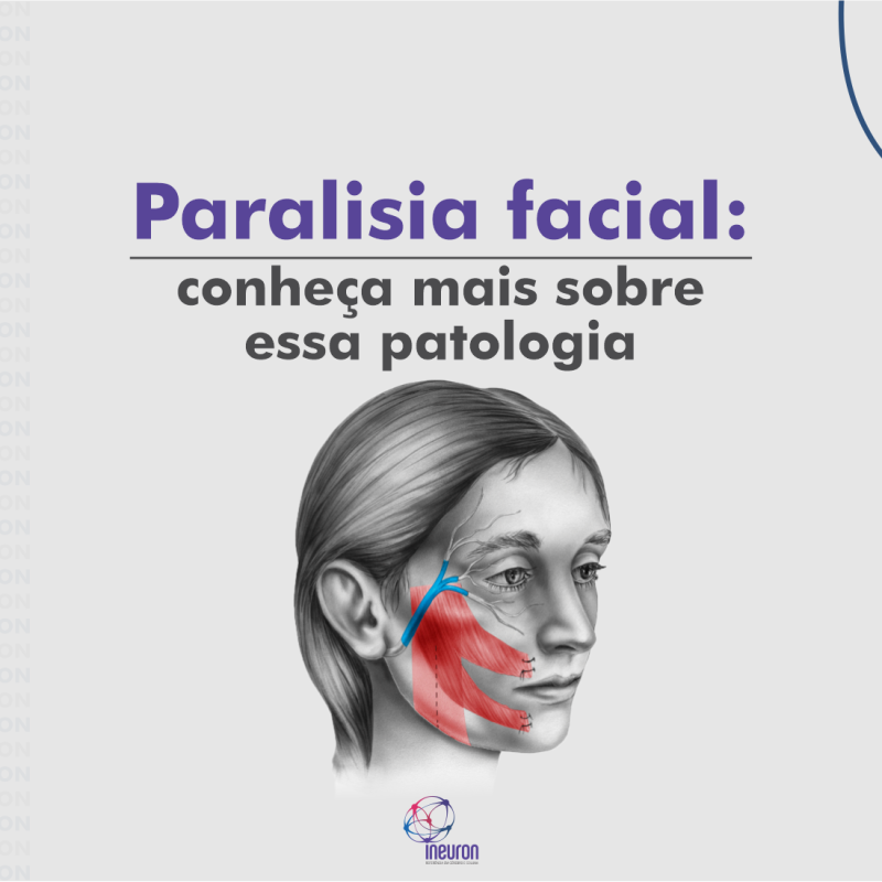 Paralisia facial: conheça mais sobre essa patologia