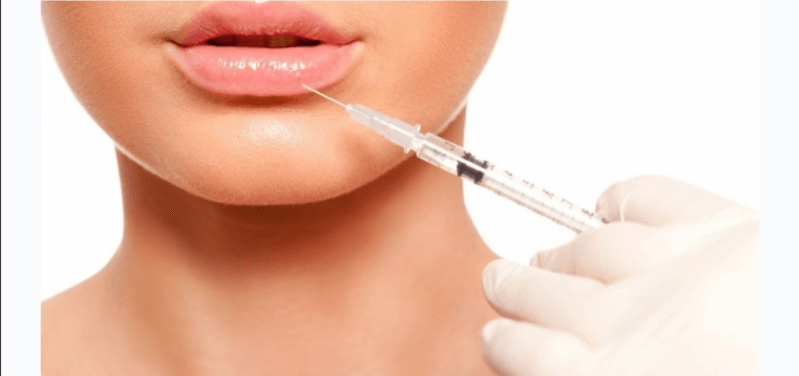 Odontoiatria estetica