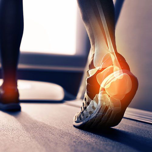 A Person Is Running on A Treadmill — Birdsboro, PA — Fleetwood Foot & Ankle Center