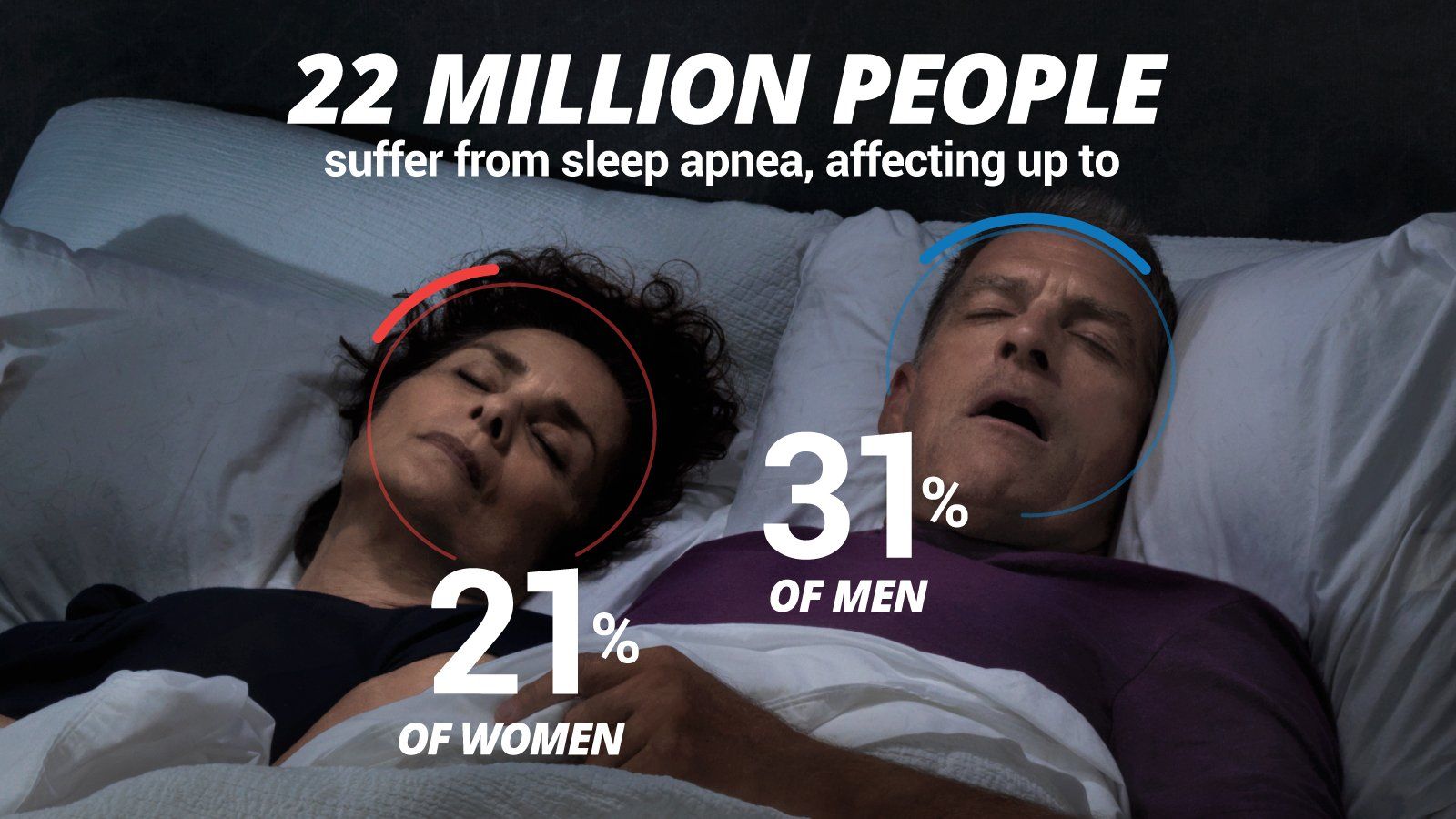 Sleep Apnea, CPAP. Oral Appliance, OSA,