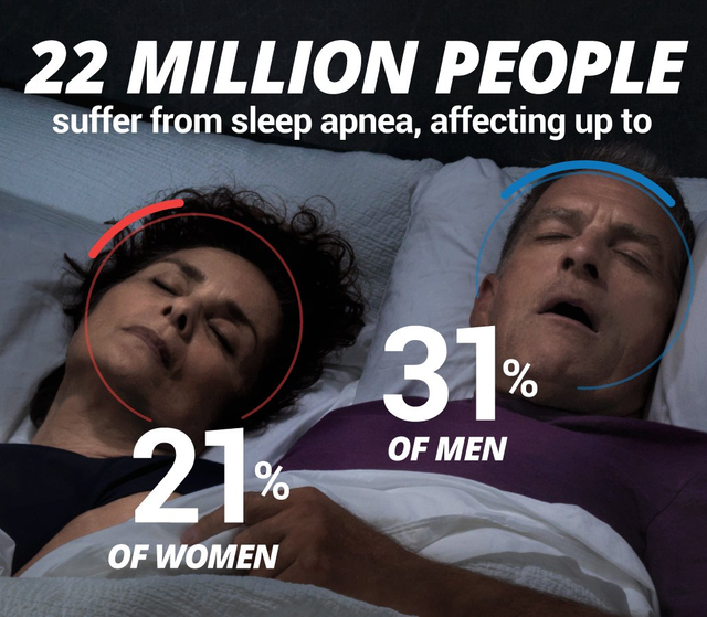 What Exactly Is Sleep Apnea?