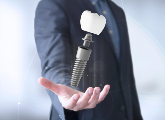 Man Holding dental implants | Dentist in Oelwein IA