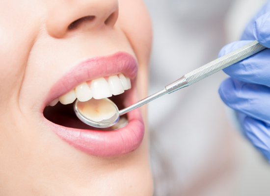 Woman with mouth open at dentist | Tooth Colored Dental Fillings in Oelwein IA