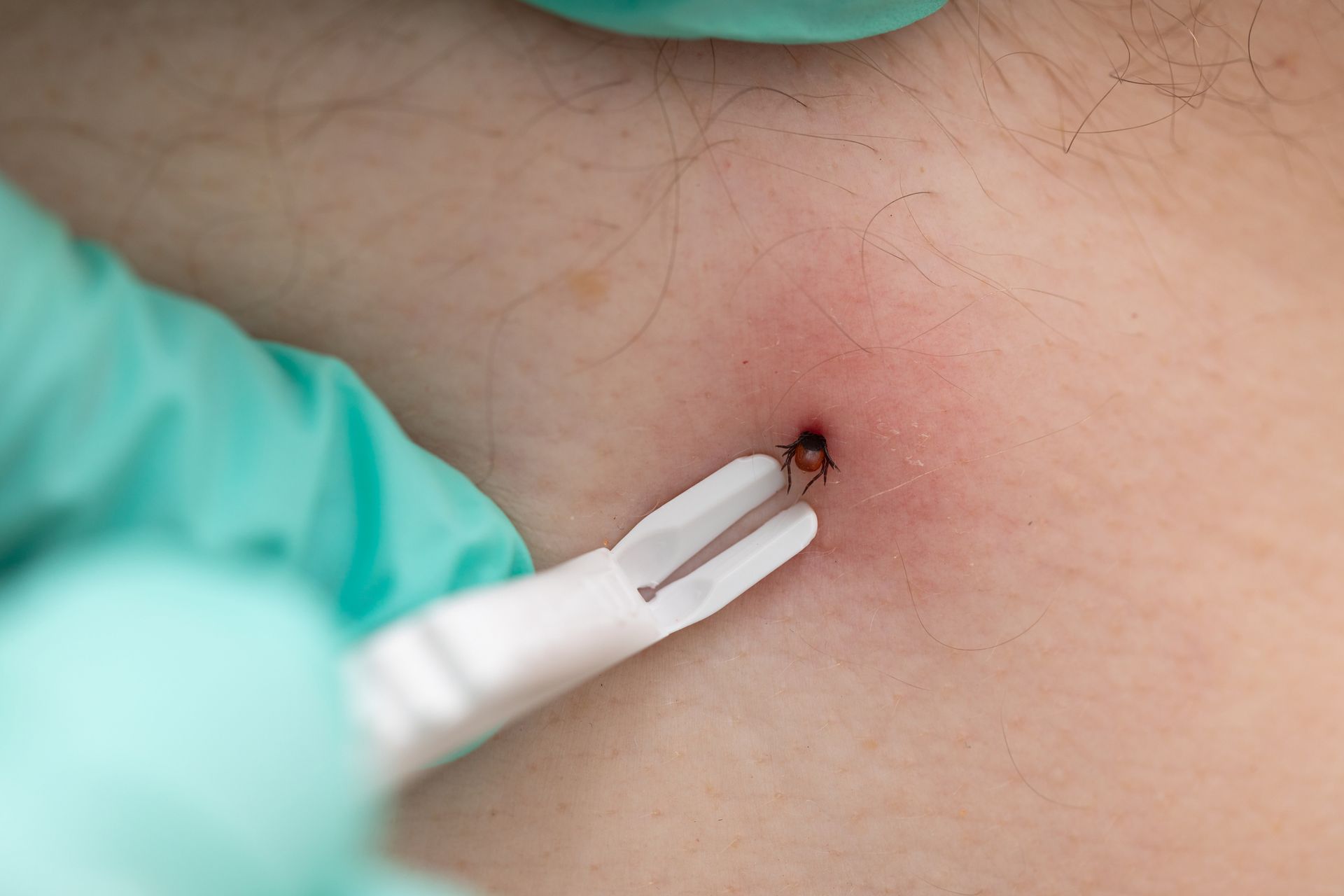 A man wearing rubber gloves is kneeling down next to a dog.