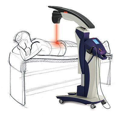 Patient receiving laser therapy for lower back pain. Red laser beam, modern medical device.