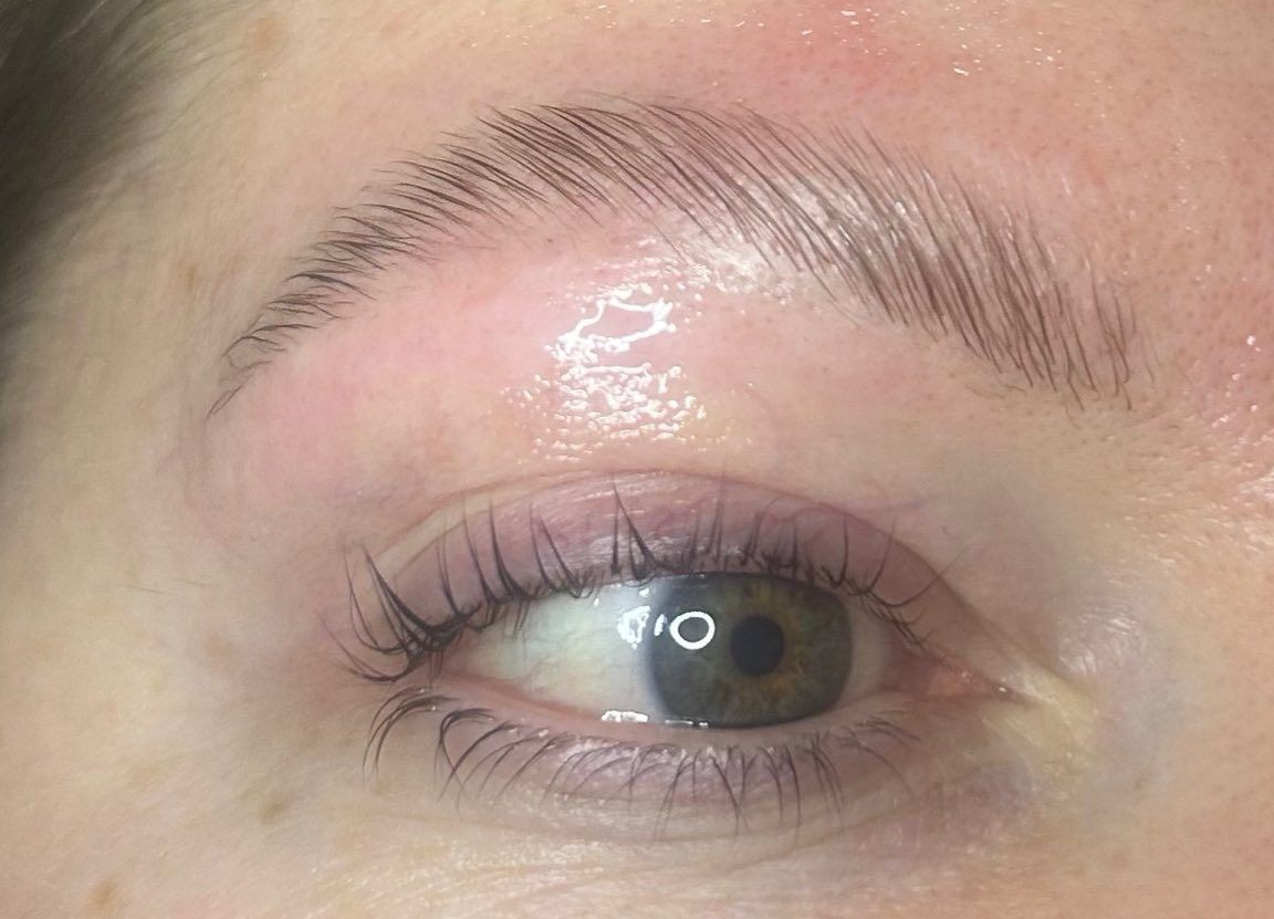 Close-up of a red eyelid above a hazel eye with shiny skin