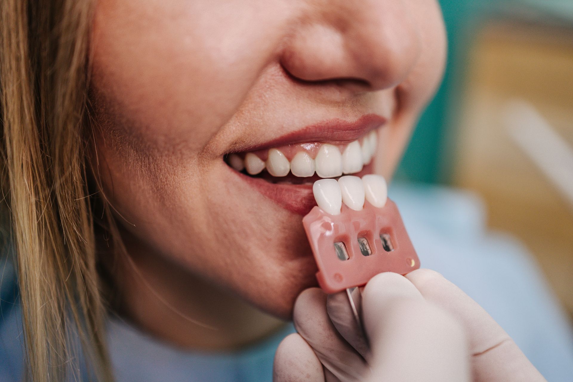 Woman smiling while holding a dental implant try-in with white teeth. A dentist in gloves is holding it.