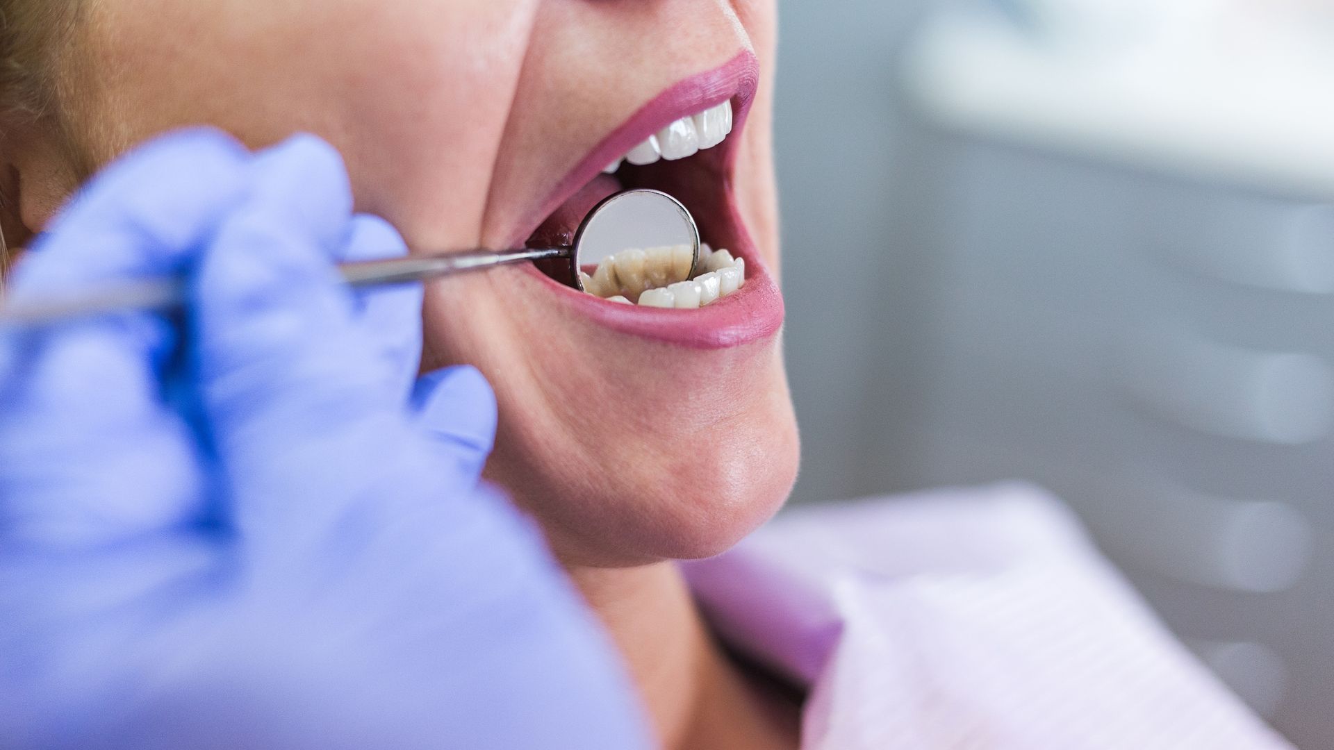 Dentist examining patient's teeth with a mirror and probe in a dental office.