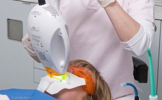 Power-Bleaching: Lichtaktivierung Power-Bleaching: Lichtaktivierung