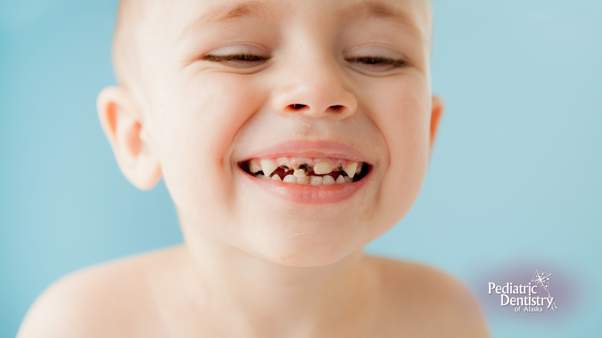 A young boy with missing teeth is smiling with his eyes closed.